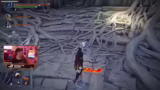 Gameplay Loop, Repetitivität…